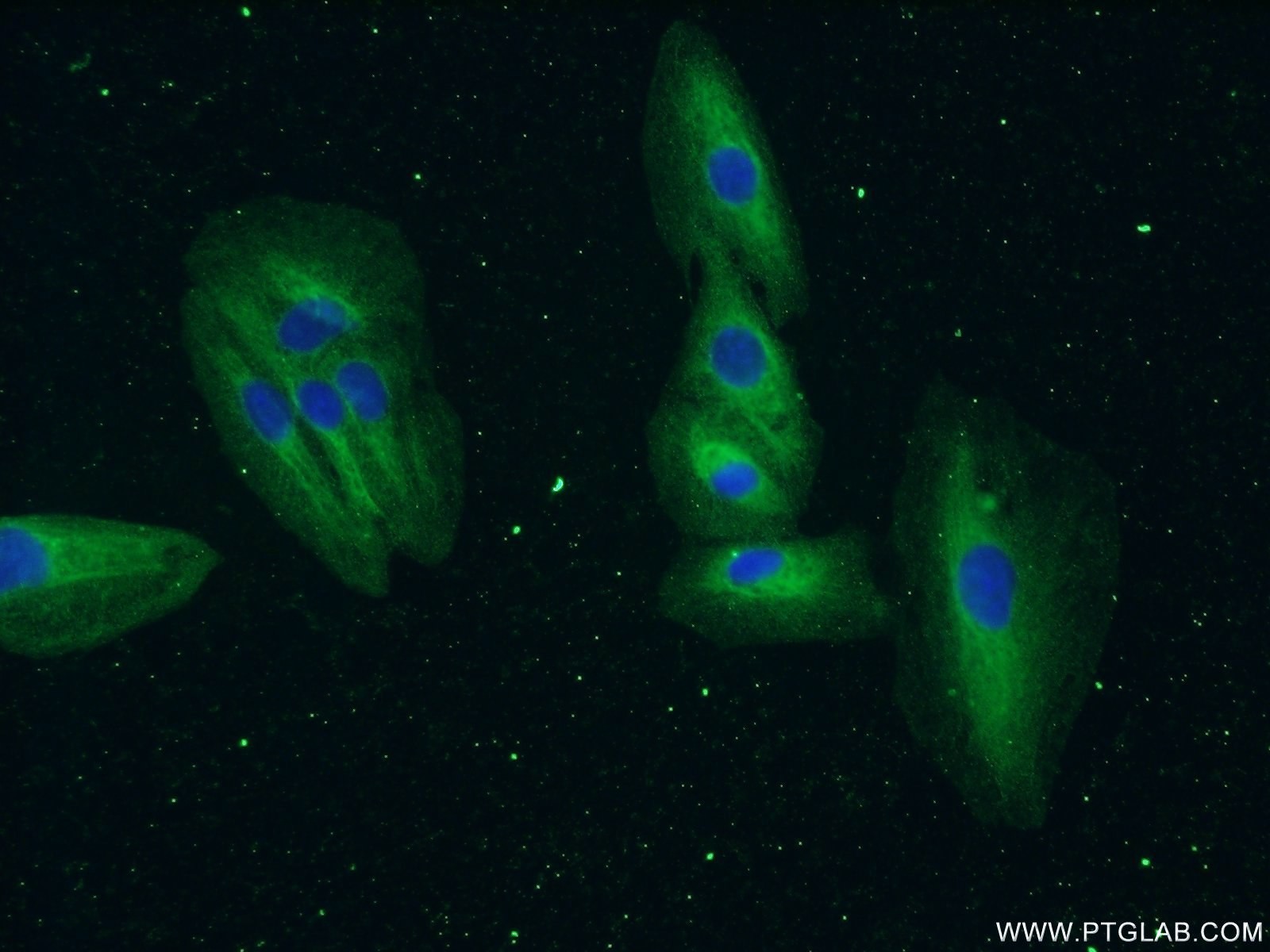 IF Staining of A549 using 22709-1-AP