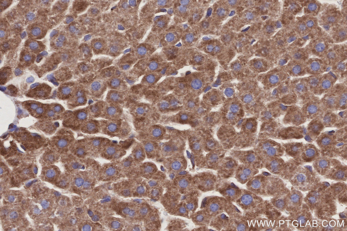 IHC staining of rat liver using 22709-1-AP IHC staining of rat liver using 22709-1-AP