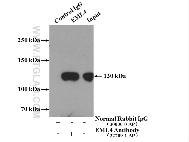 EML4 Polyclonal antibody