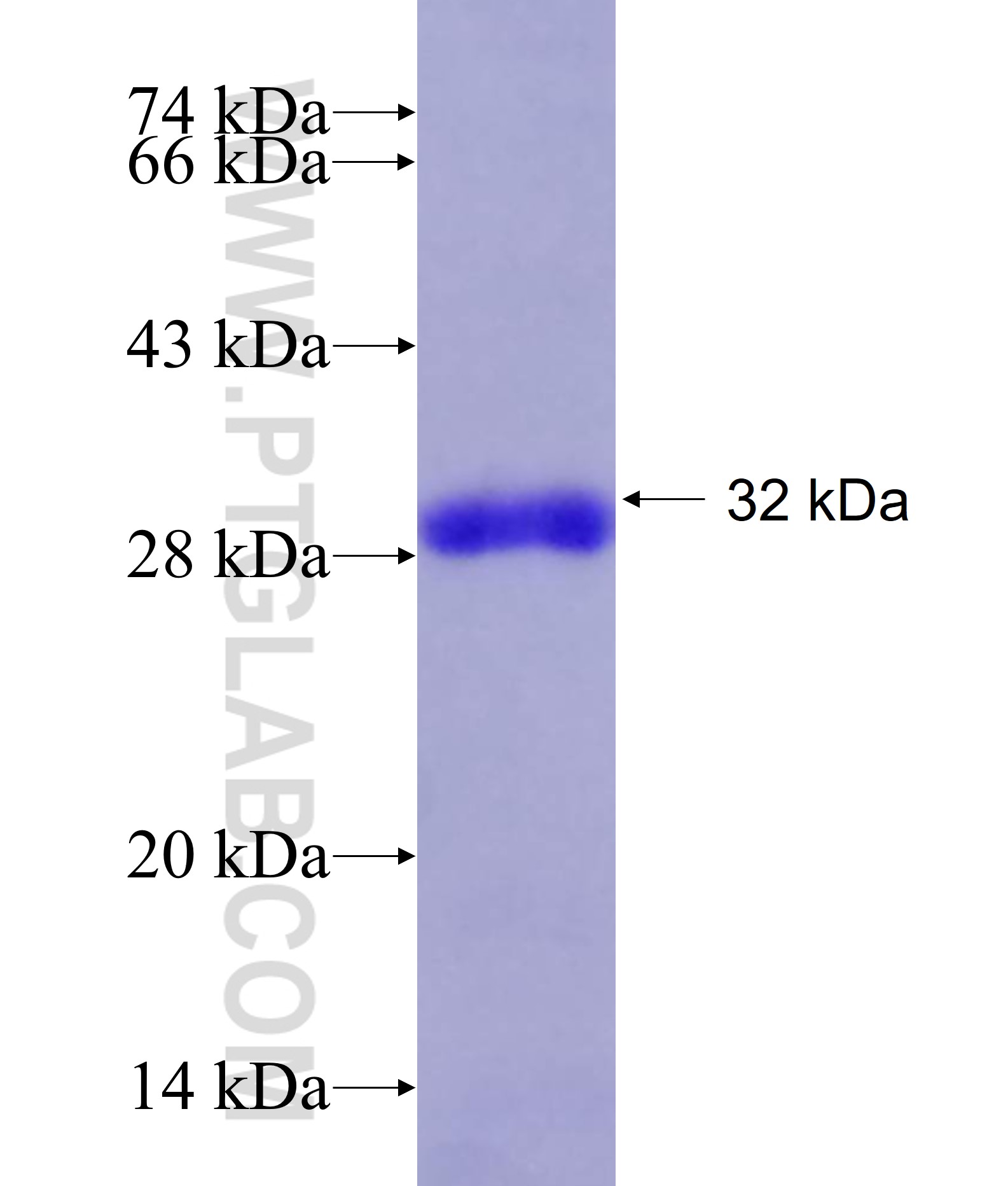 EML4 fusion protein Ag18755 SDS-PAGE