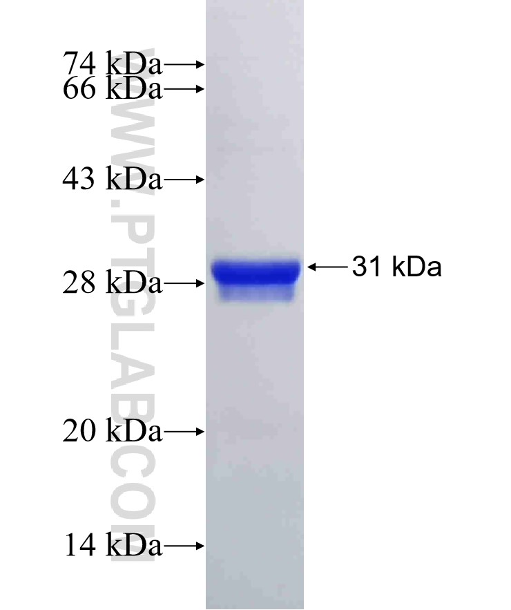 EMP1 fusion protein Ag32616 SDS-PAGE