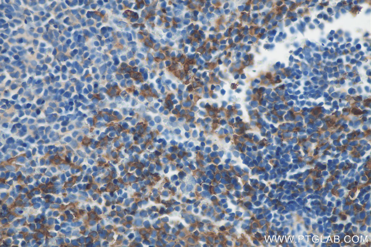 IHC staining of mouse spleen using 27044-1-AP