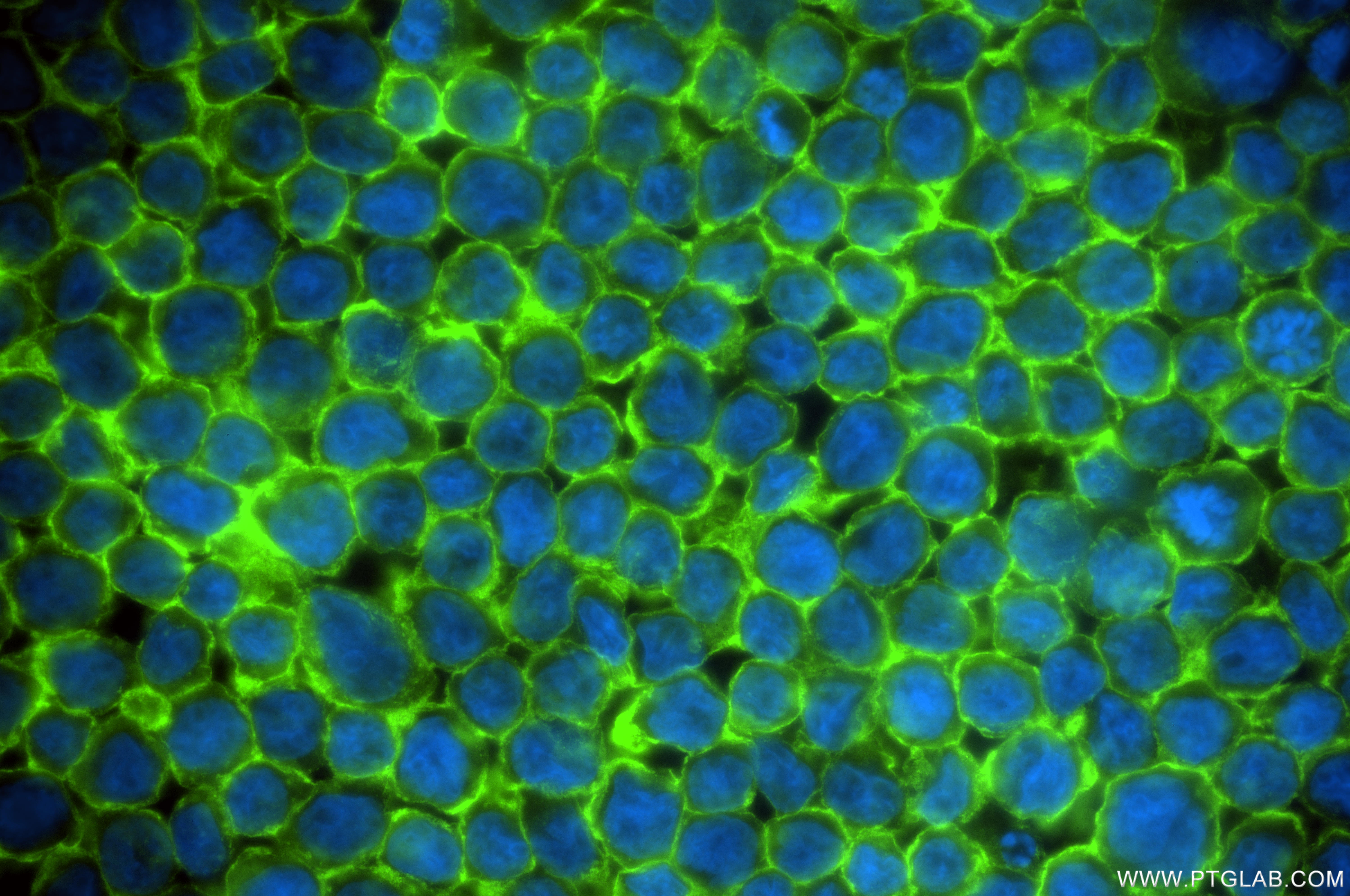 IF Staining of THP-1 using 84608-5-RR