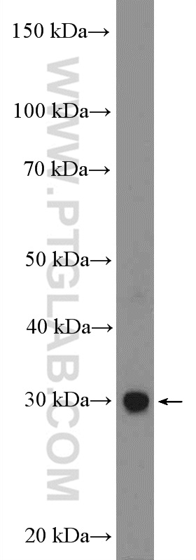 WB analysis of mouse brain using 55032-1-AP