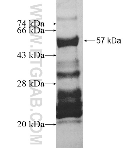 EMX1 fusion protein Ag13286 SDS-PAGE EMX1 fusion protein Ag13286 SDS-PAGE