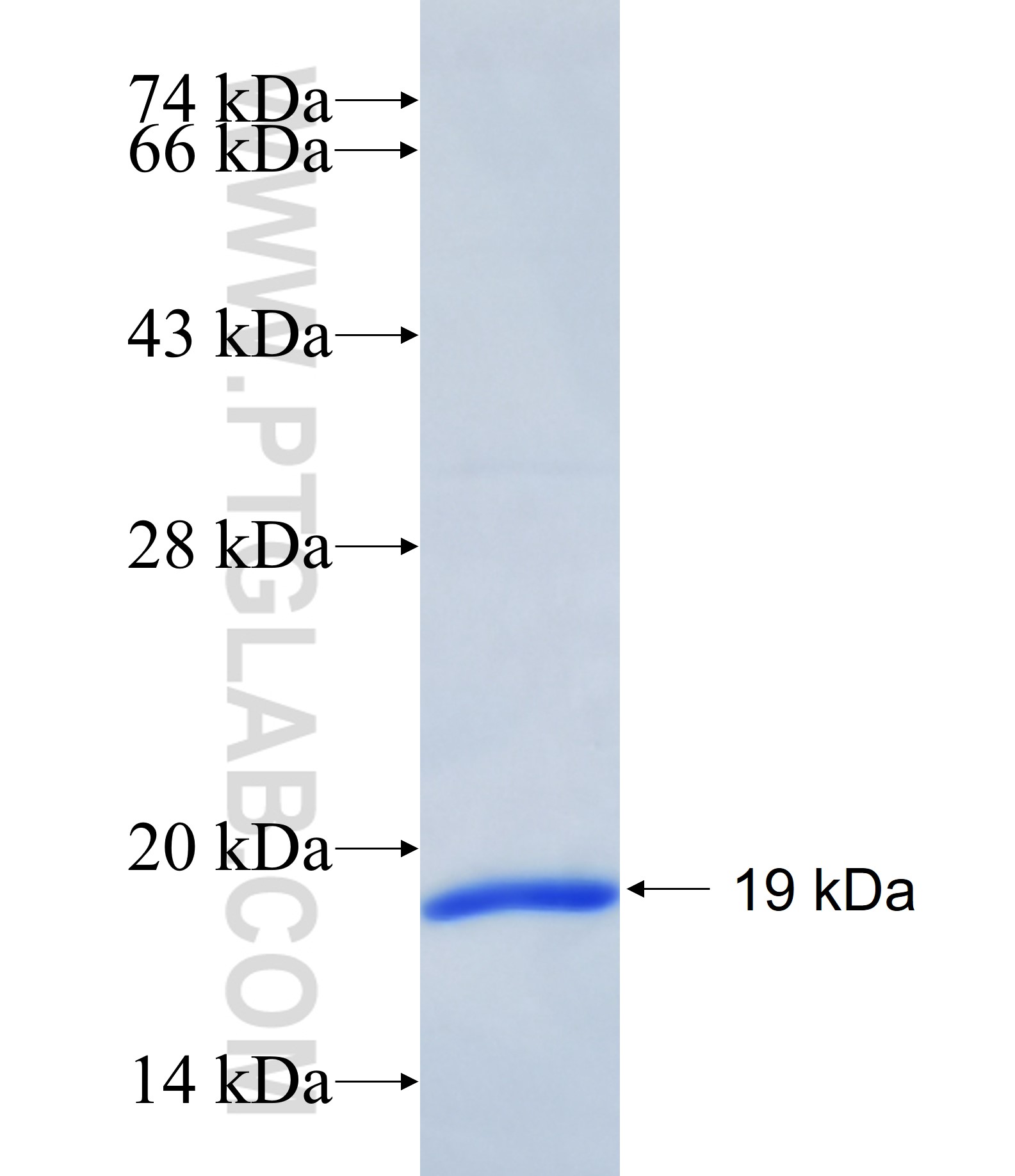 EMX2 fusion protein Ag38632 SDS-PAGE EMX2 fusion protein Ag38632 SDS-PAGE
