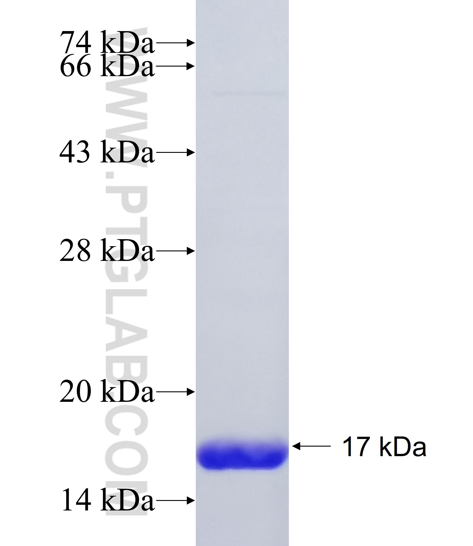 EN1 fusion protein Ag34937 SDS-PAGE EN1 fusion protein Ag34937 SDS-PAGE