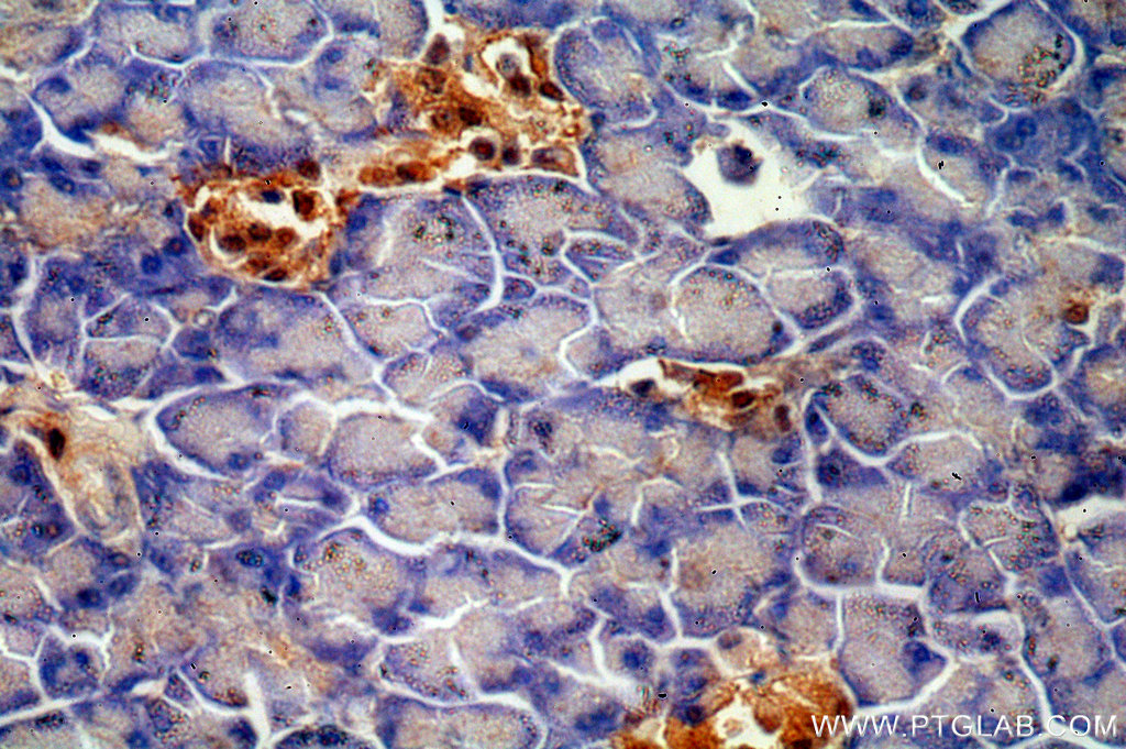 IHC staining of human pancreas using 15007-1-AP