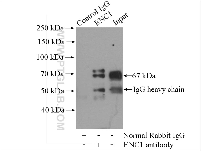 IP experiment of mouse brain using 15007-1-AP