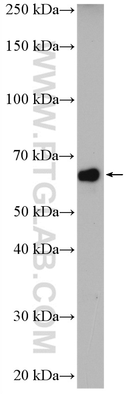 WB analysis of SH-SY5Y using 15007-1-AP