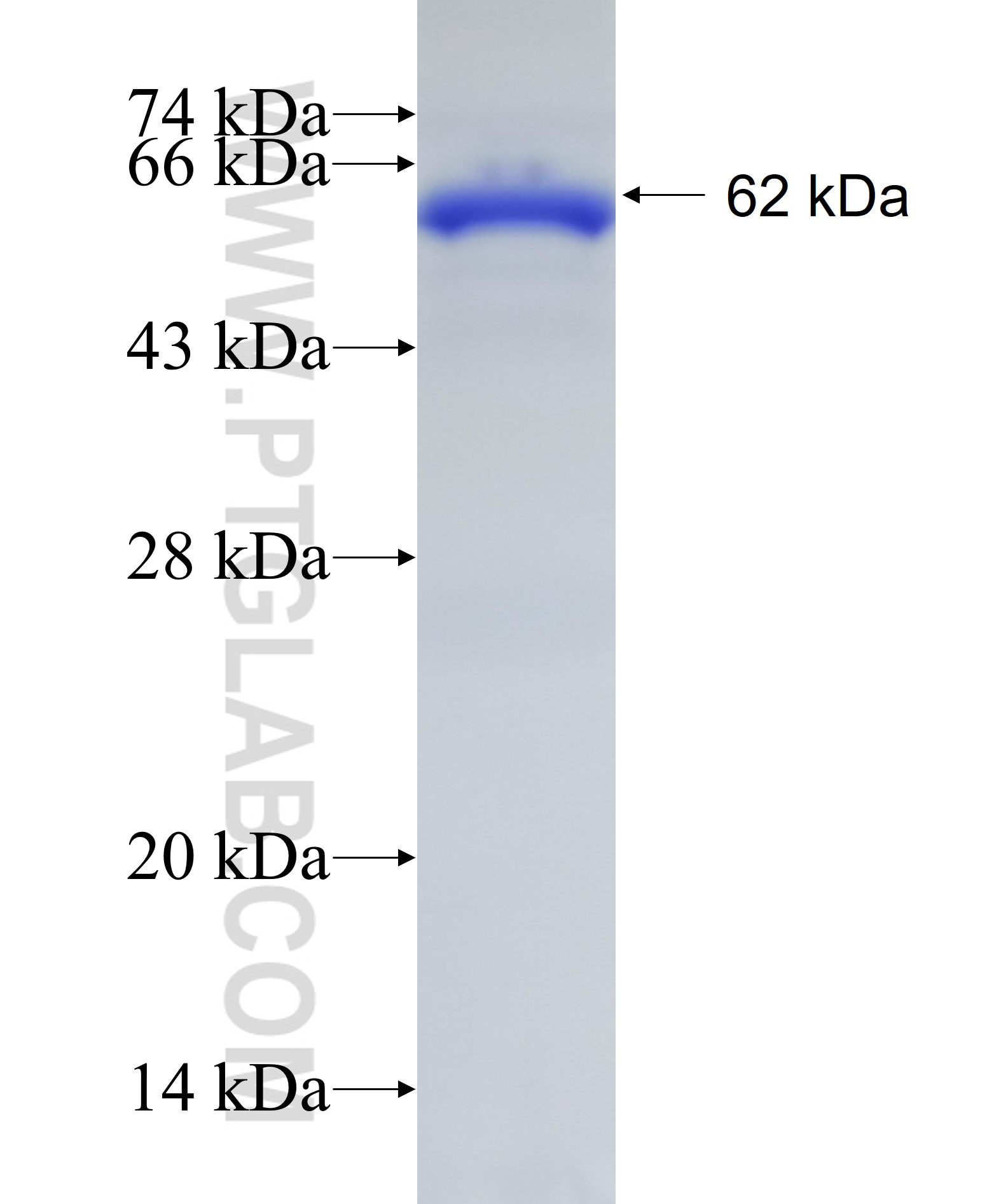 ENC1 fusion protein Ag6510 SDS-PAGE