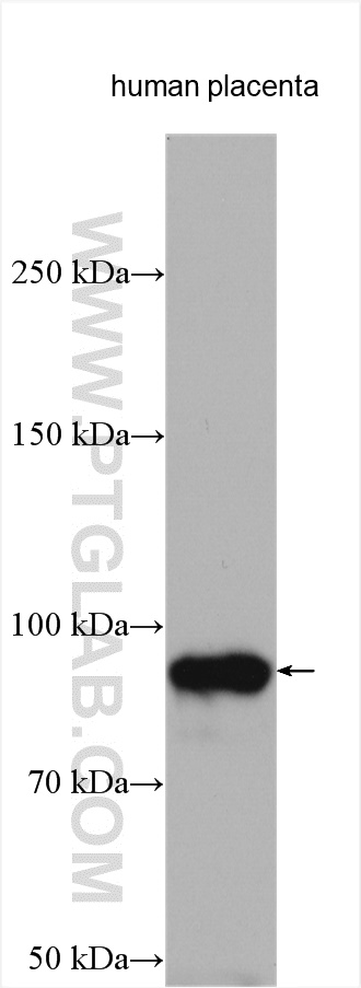 WB analysis using 10862-1-AP