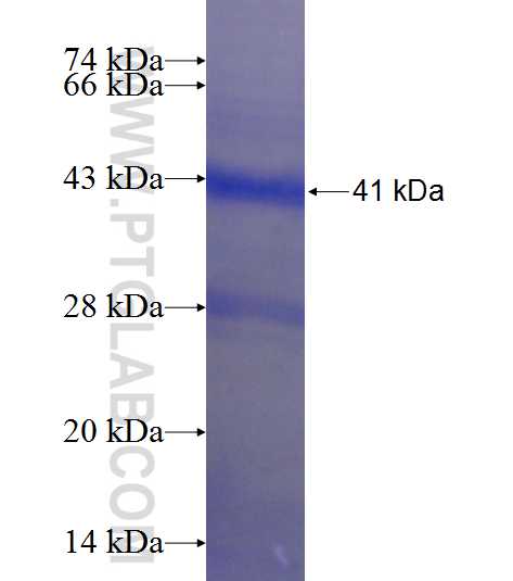 Endoglin/CD105 fusion protein Ag23427 SDS-PAGE