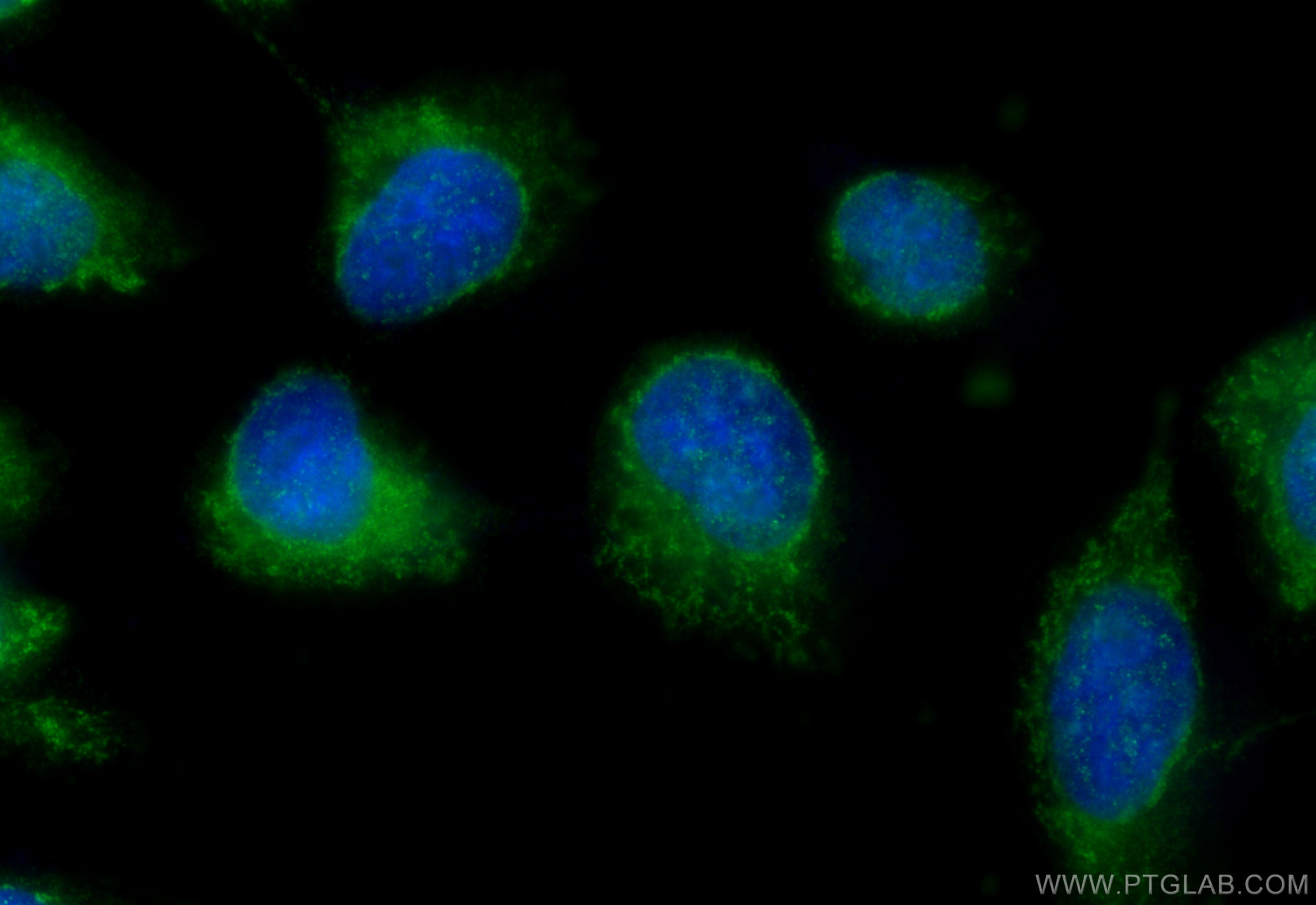 IF Staining of U-251 using 31784-1-AP
