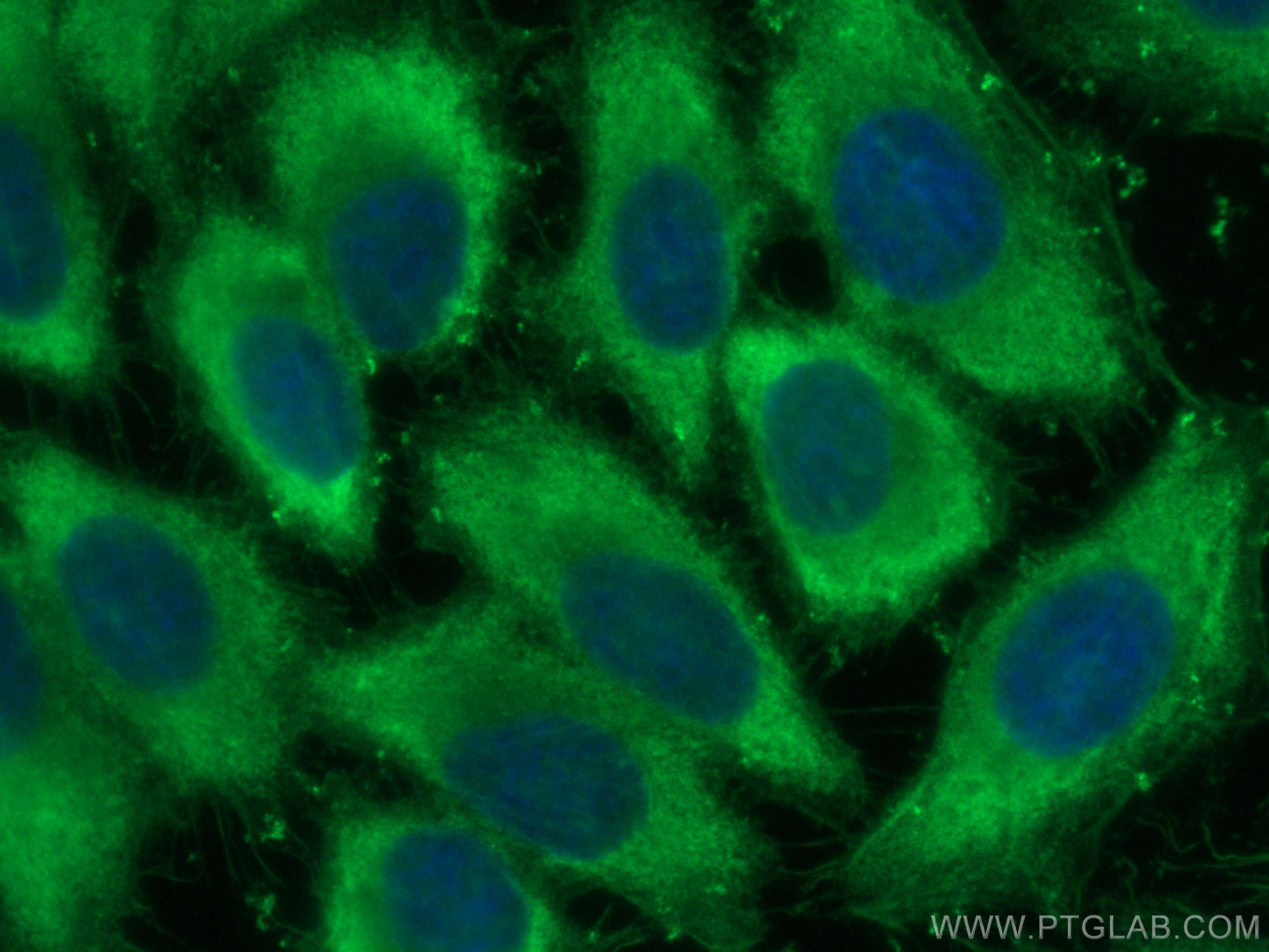 IF Staining of HepG2 using 81504-1-RR (same clone as 81504-1-PBS)