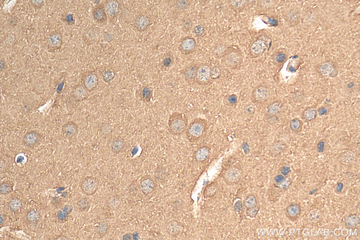 IHC staining of mouse brain using 81504-1-RR (same clone as 81504-1-PBS)