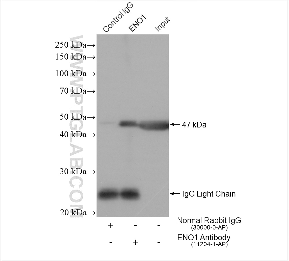 IP experiment of mouse skeletal muscle using 11204-1-AP