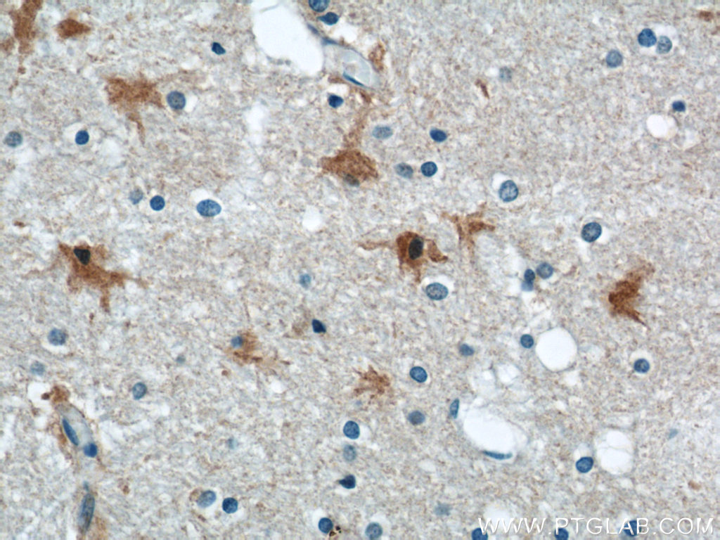 IHC staining of human brain using 55237-1-AP