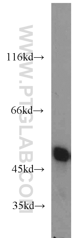 WB analysis of HeLa using 55237-1-AP