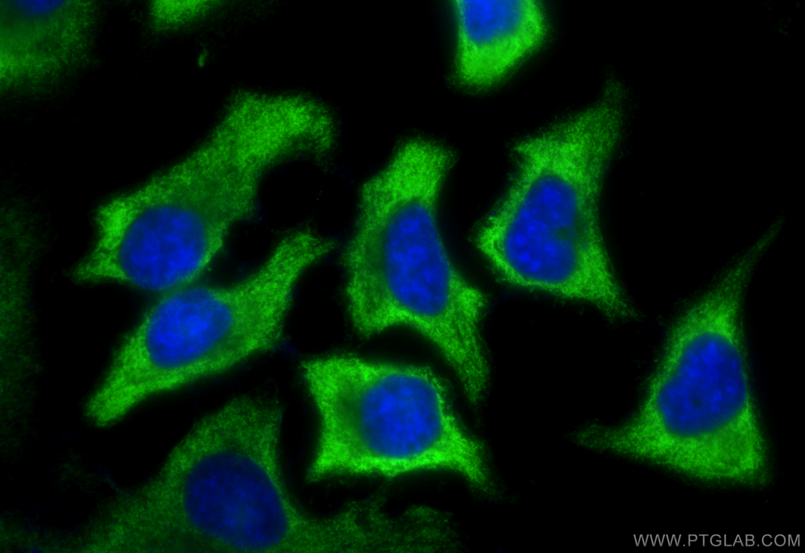 IF Staining of HeLa using 67187-1-Ig (same clone as 67187-1-PBS)