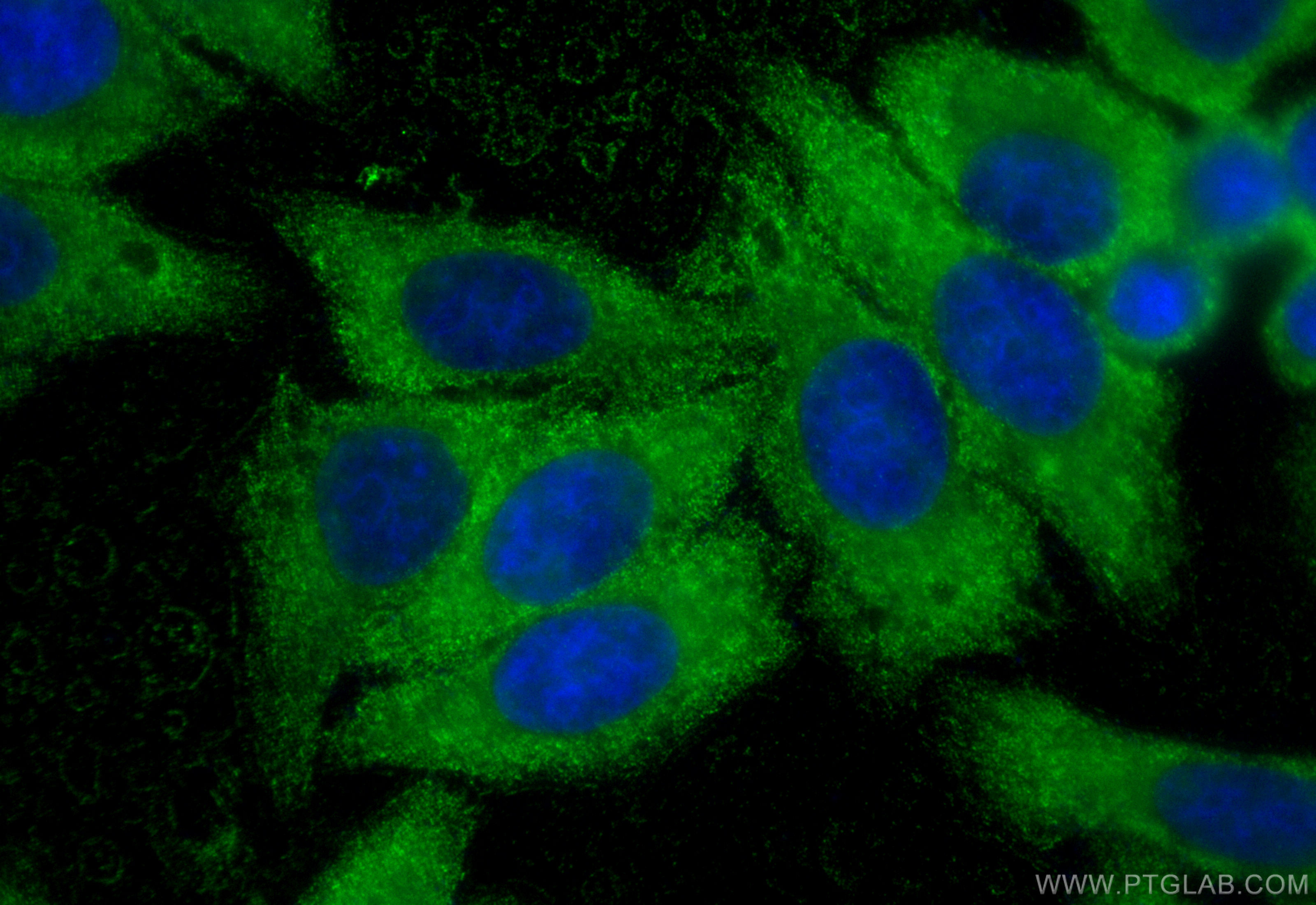 IF Staining of HepG2 using 67187-1-Ig