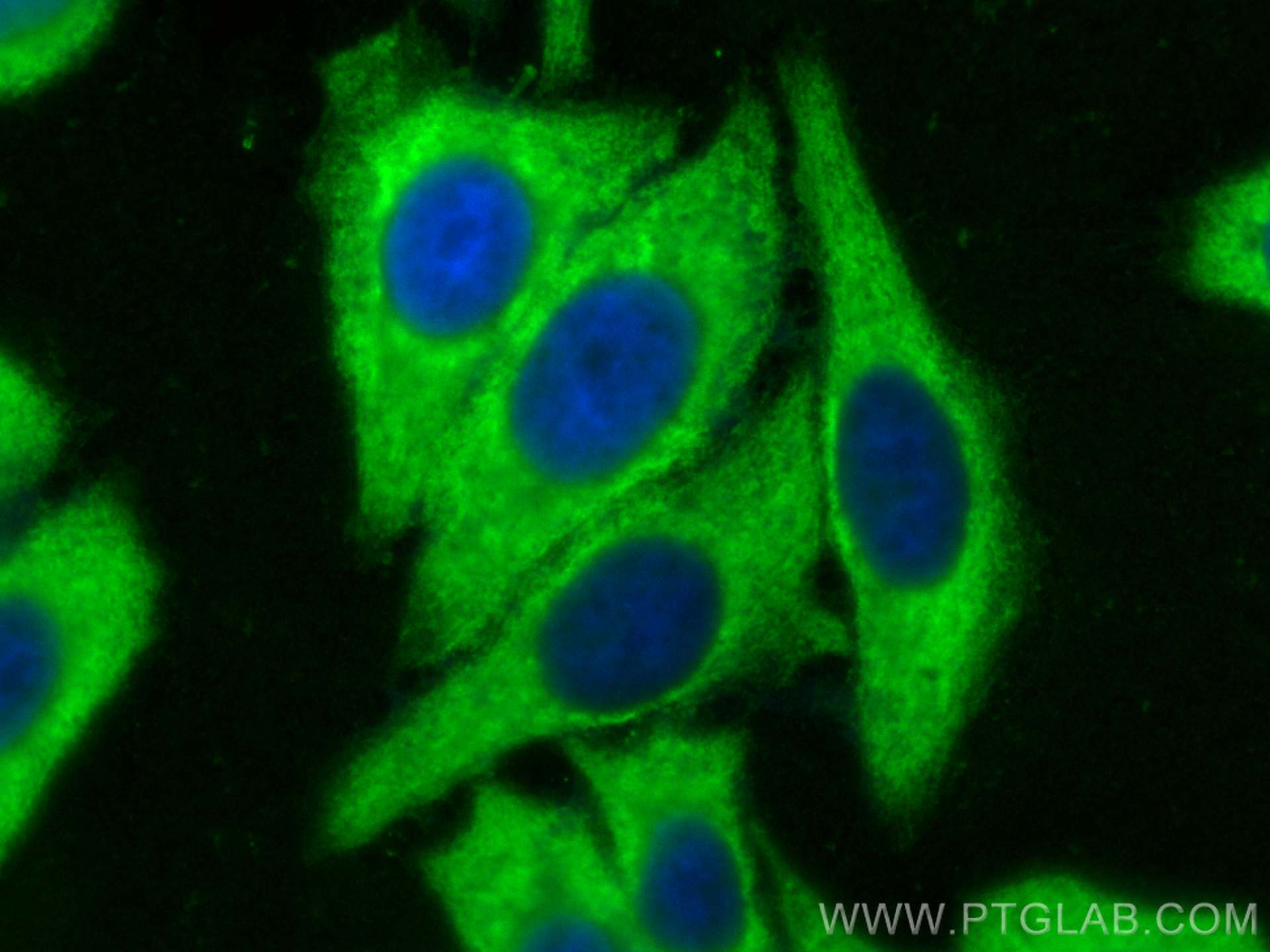 IF Staining of HepG2 using 81478-1-RR (same clone as 81478-1-PBS)