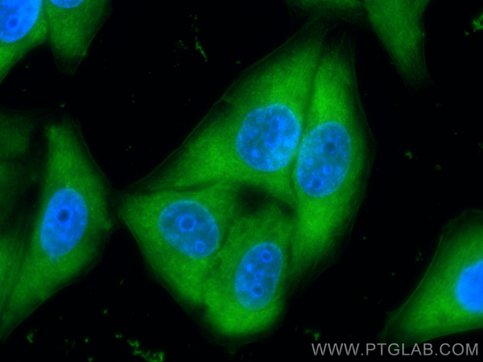 IF Staining of HepG2 using CL488-81478