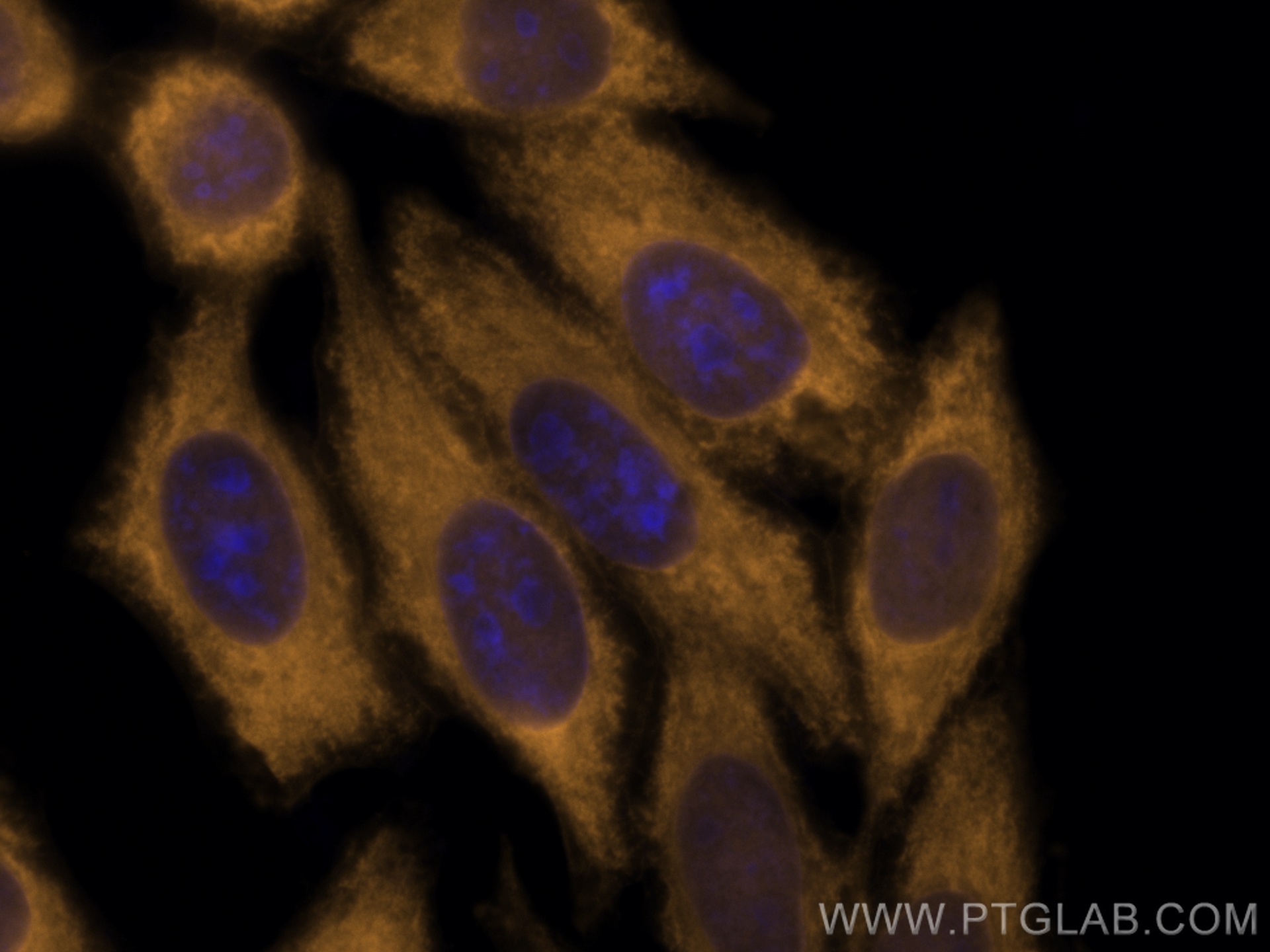 IF Staining of HepG2 using CL555-11204