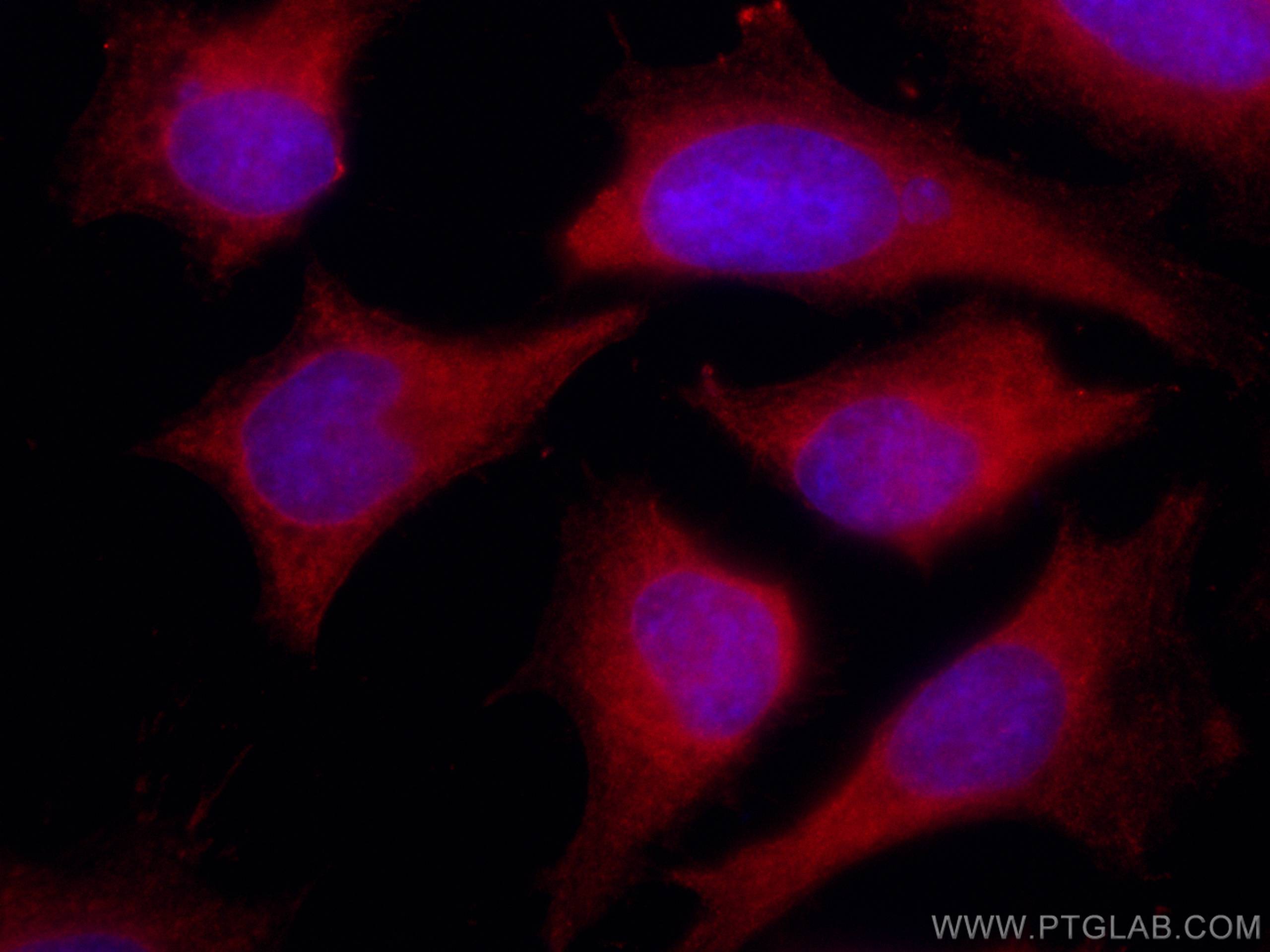 IF Staining of HeLa using CL594-67187