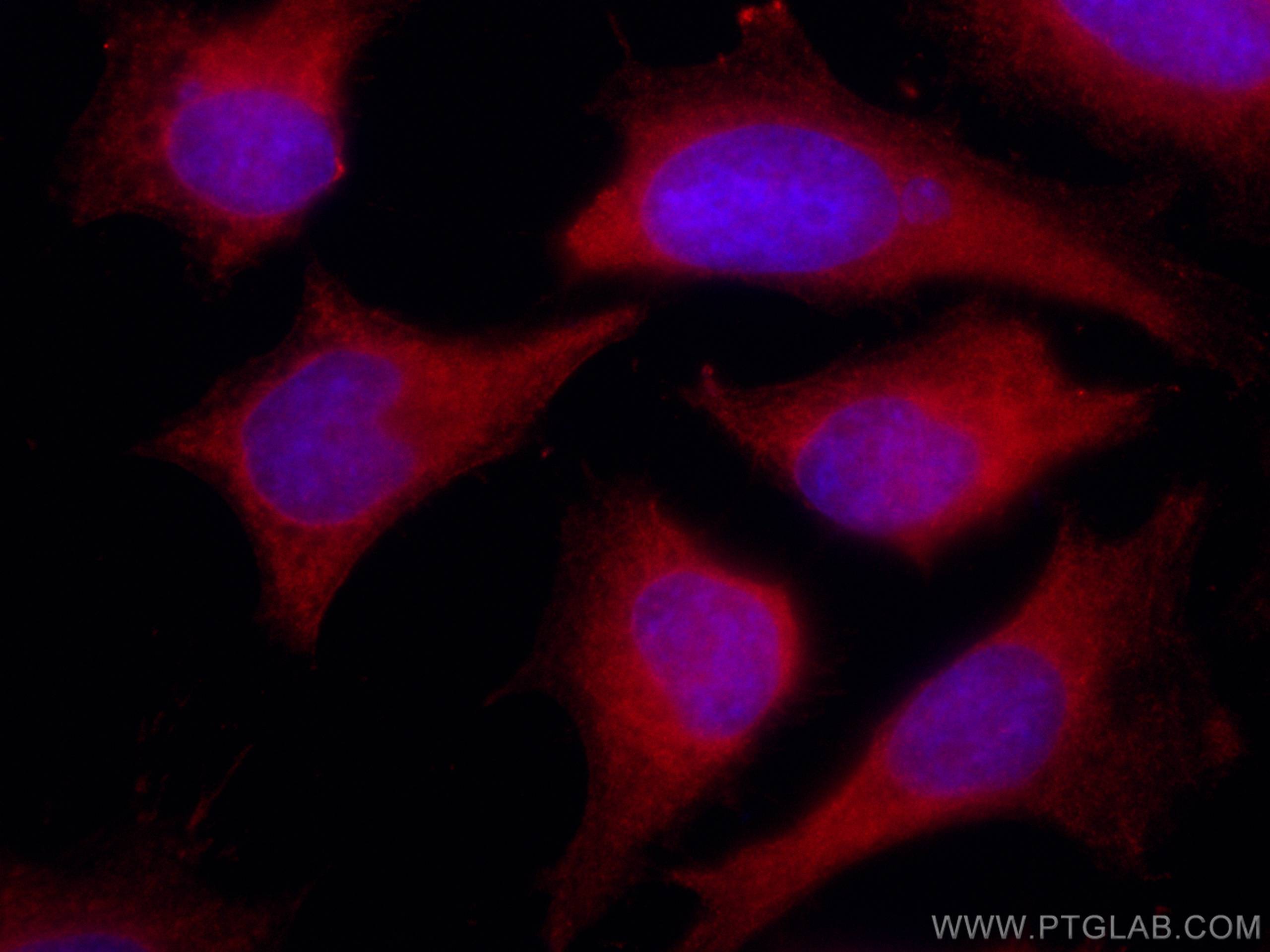 IF Staining of HeLa using CL594-67187