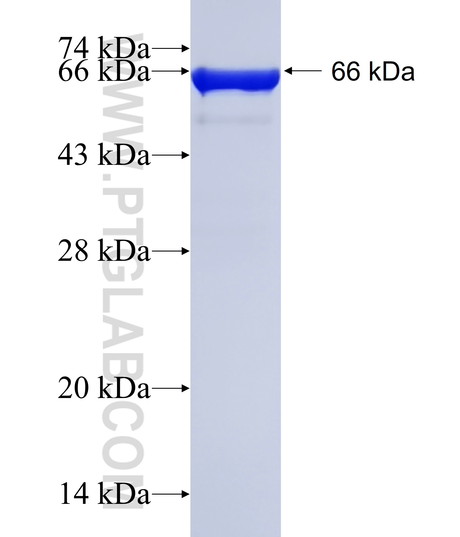 ENO1 fusion protein Ag1692 SDS-PAGE