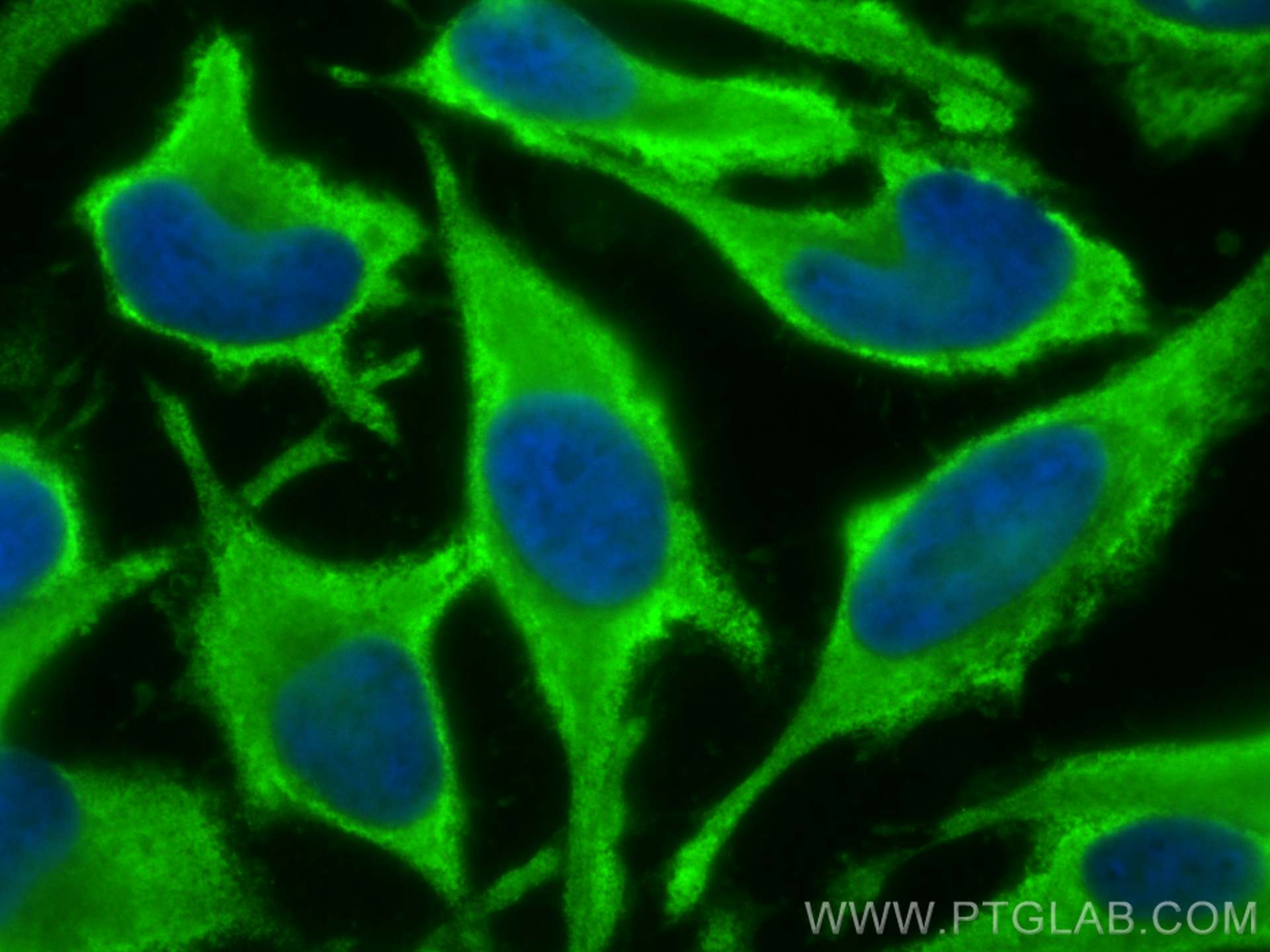 IF Staining of HeLa using 10149-1-AP