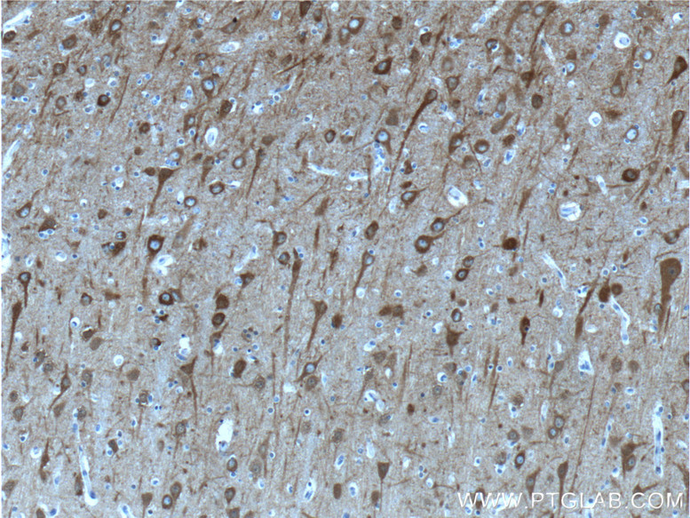 IHC staining of human brain using 10149-1-AP