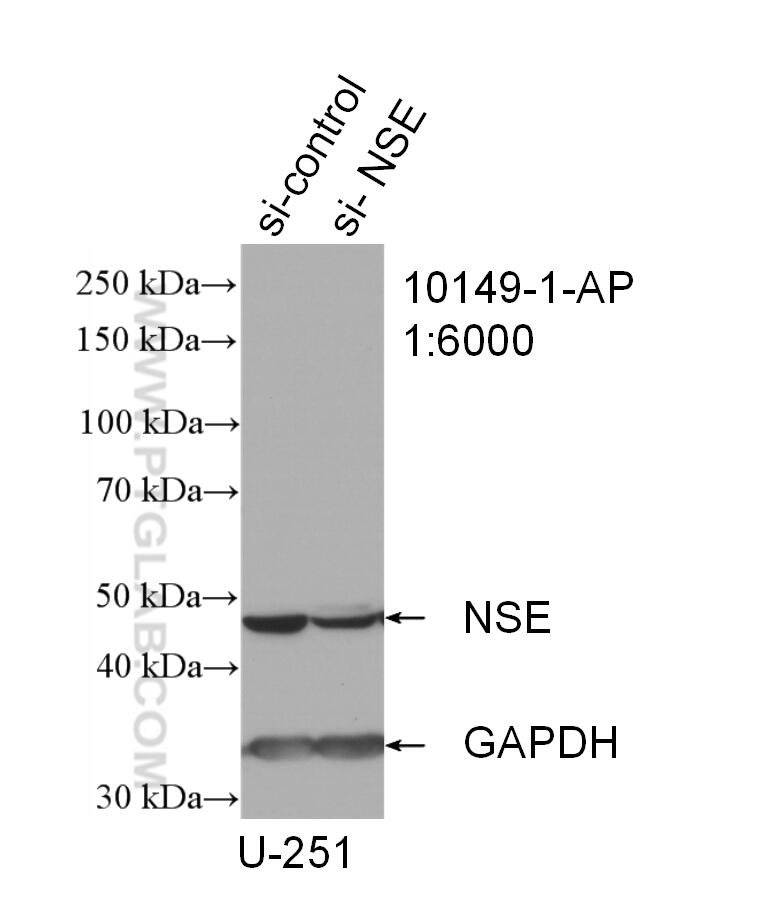 WB analysis of U-251 using 10149-1-AP