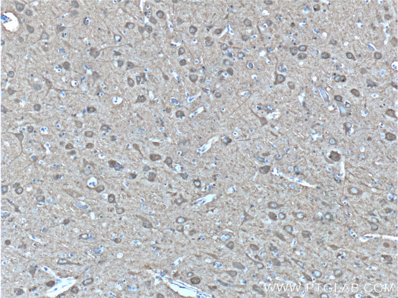 IHC staining of human brain using 55235-1-AP