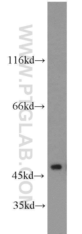 WB analysis of SH-SY5Y using 55235-1-AP