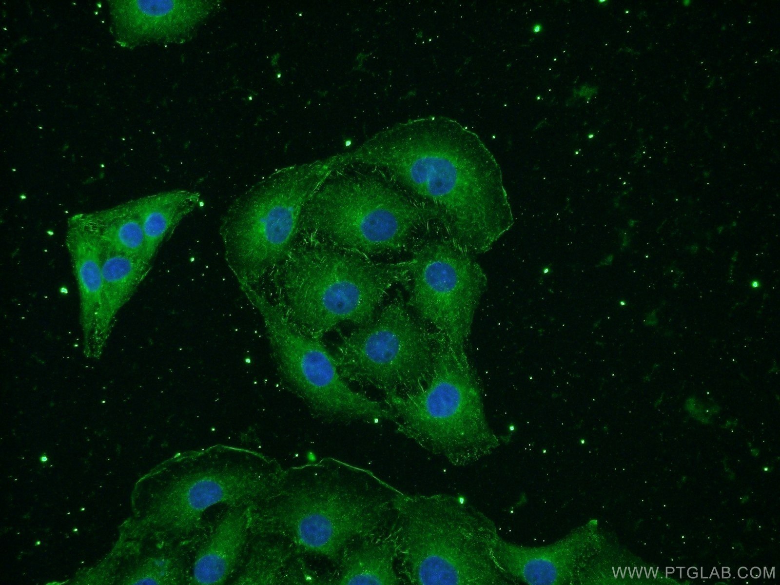 IF Staining of SH-SY5Y using 66150-1-Ig (same clone as 66150-1-PBS)