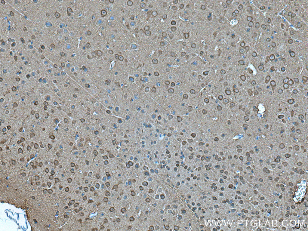 IHC staining of mouse brain using 66150-1-Ig (same clone as 66150-1-PBS)