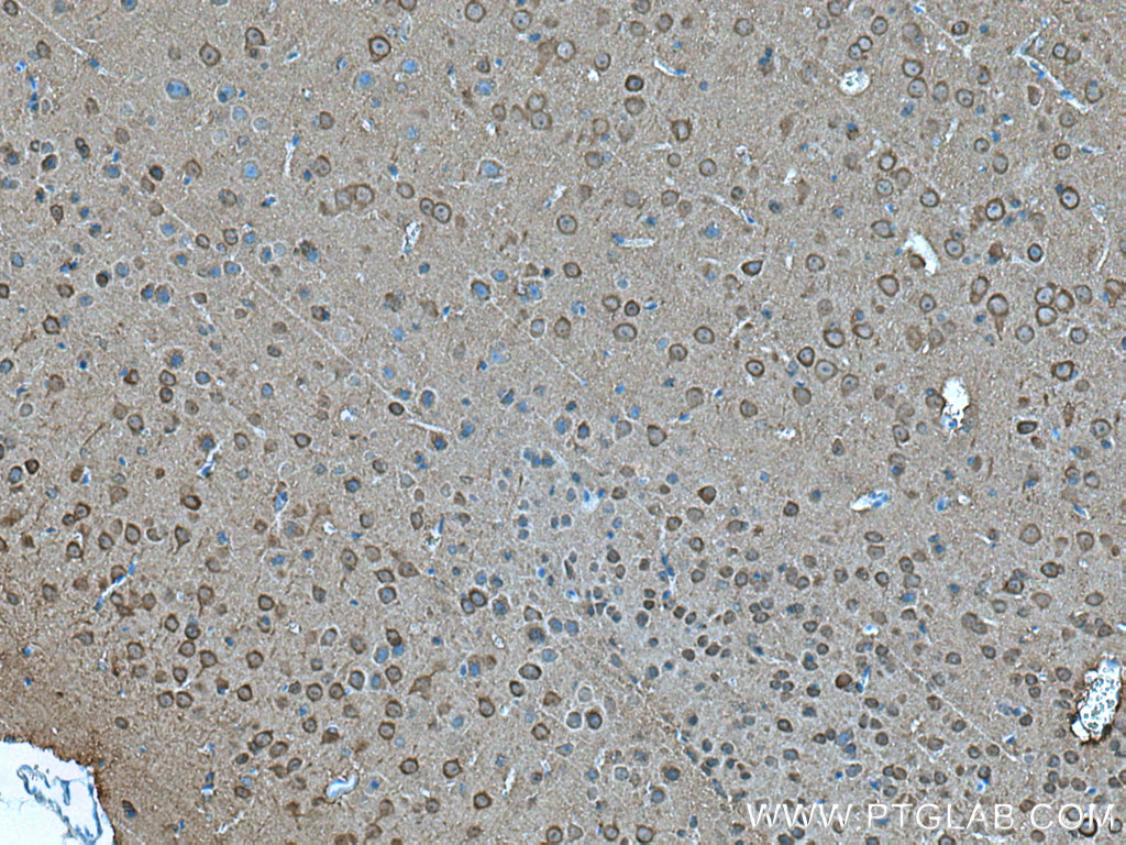 IHC staining of mouse brain using 66150-1-Ig