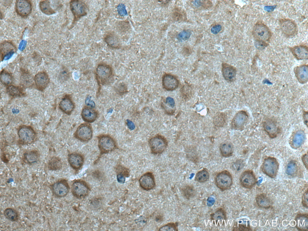 IHC staining of mouse brain using 66150-1-Ig (same clone as 66150-1-PBS)