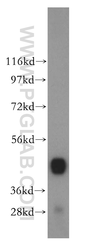 WB analysis of human skeletal muscle using 16421-1-AP (same clone as 16421-1-PBS)
