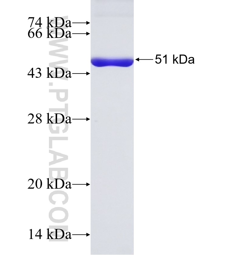 ENO3 fusion protein Ag33421 SDS-PAGE ENO3 fusion protein Ag33421 SDS-PAGE