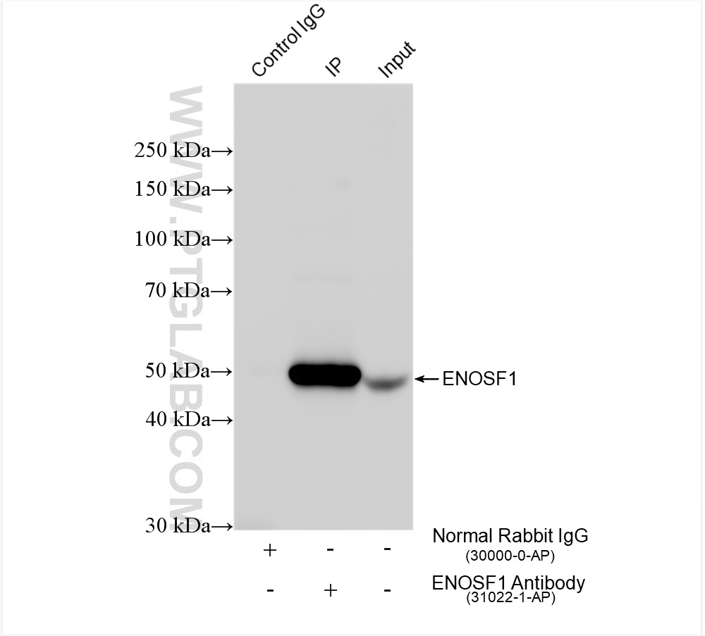 IP experiment of MCF-7 using 31022-1-AP