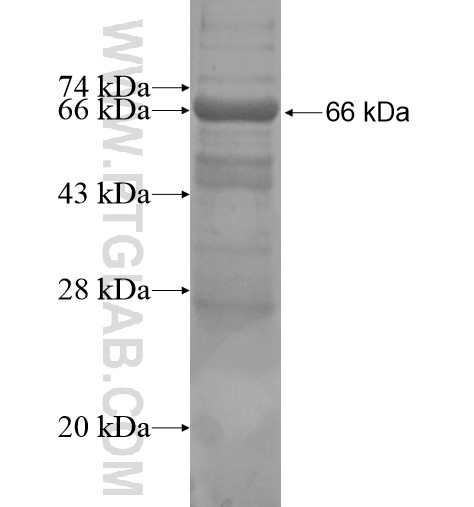 ENOX1 fusion protein Ag13533 SDS-PAGE ENOX1 fusion protein Ag13533 SDS-PAGE