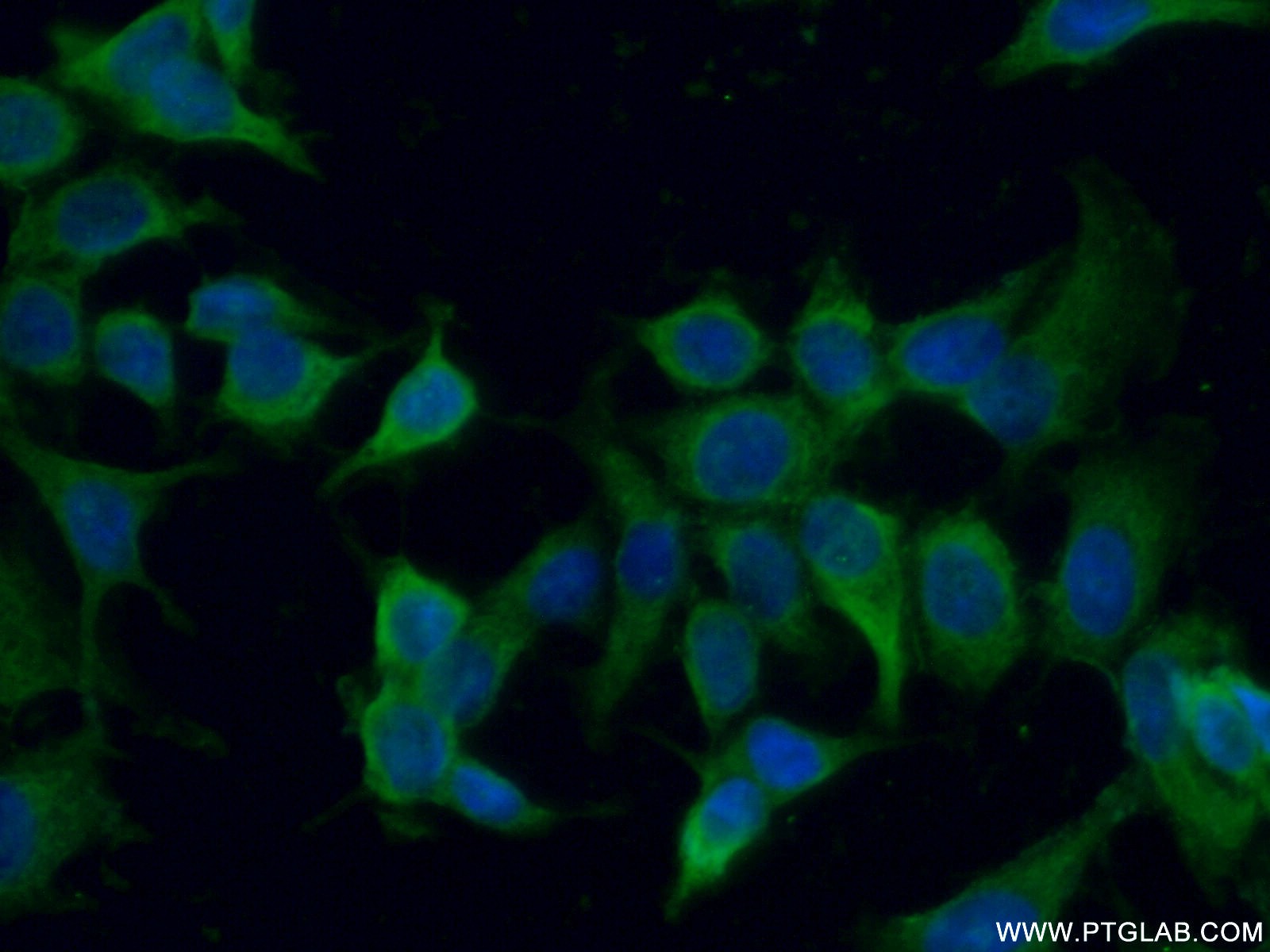 IF Staining of MCF-7 using 10423-1-AP