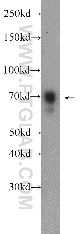 WB analysis of MCF-7 using 10423-1-AP