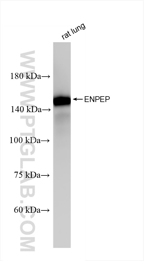 WB analysis of rat lung using 85963-1-RR (same clone as 85963-1-PBS)