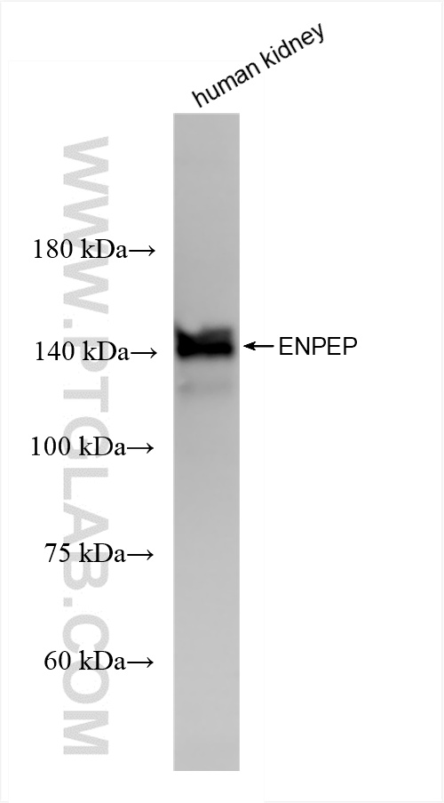 WB analysis of human kidney using 85963-1-RR (same clone as 85963-1-PBS)