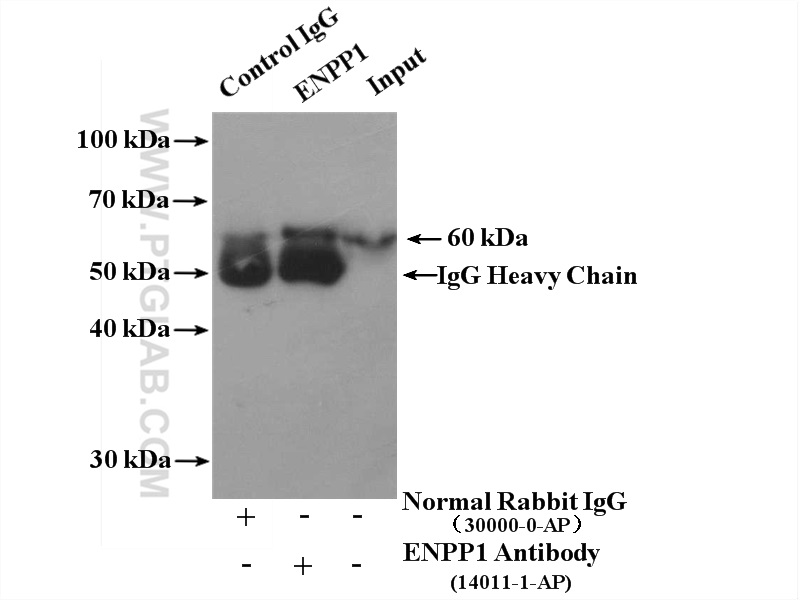 IP experiment of Raji using 14011-1-AP