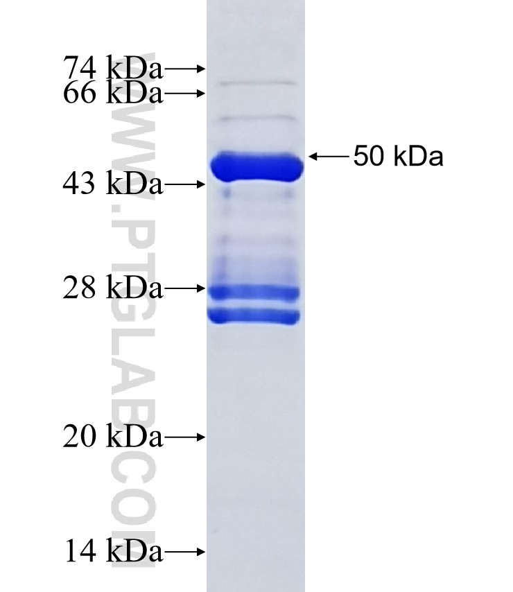 ENPP3 fusion protein Ag18813 SDS-PAGE ENPP3 fusion protein Ag18813 SDS-PAGE